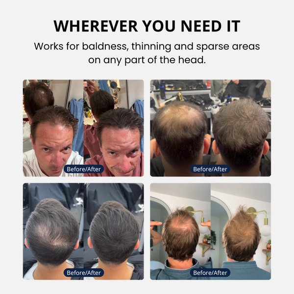Hairvanta™ – Premium Density Cream for Thicker-Looking Hair