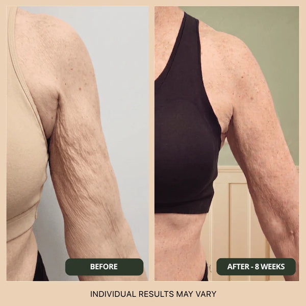 Velmira™ – Aceite corporal hidratante con péptidos para una piel suave