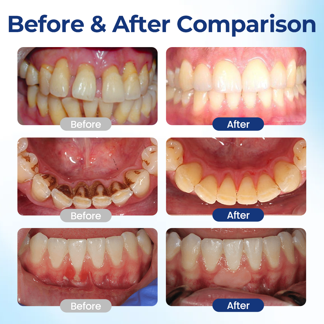 OralVive™ Bee Venom Oral Care Solution ⭐