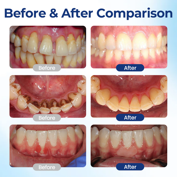OralVive™ Bee Venom Oral Care Solution ⭐