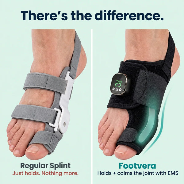 Footvera™ – Corrector de juanetes EMS para un soporte de alineación suave
