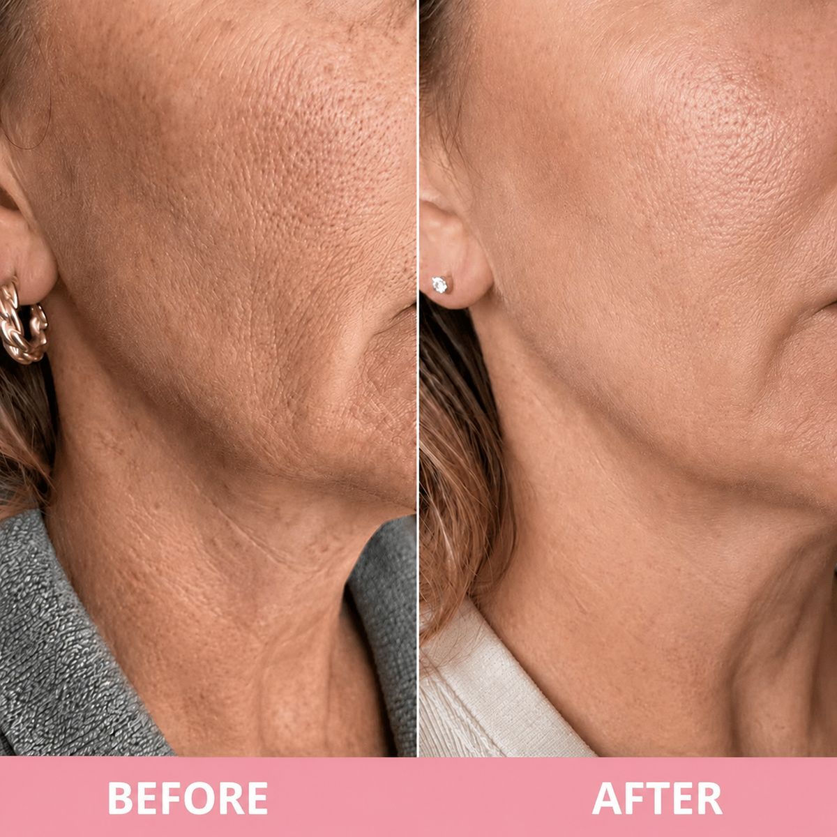 NeckSculpt™ PDRN Collagen Gua Sha Cream