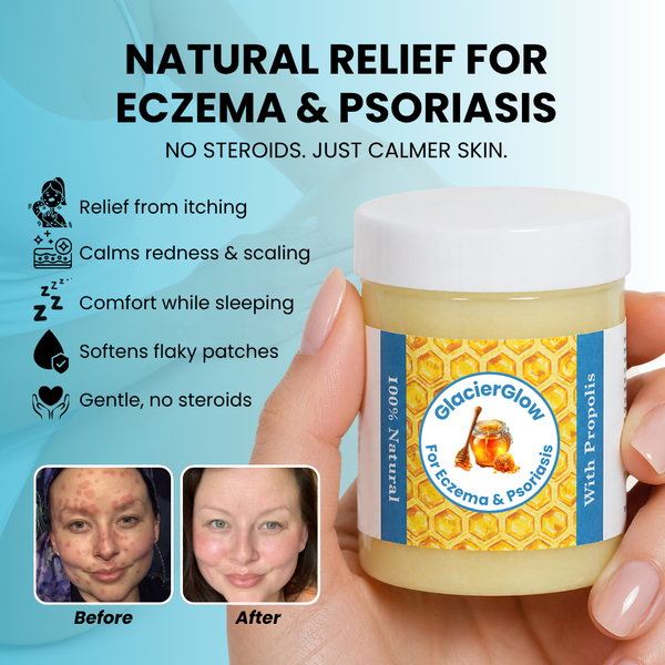 DermaFrost™ – Soothing Balm for Dry, Sensitive & Irritated Skin