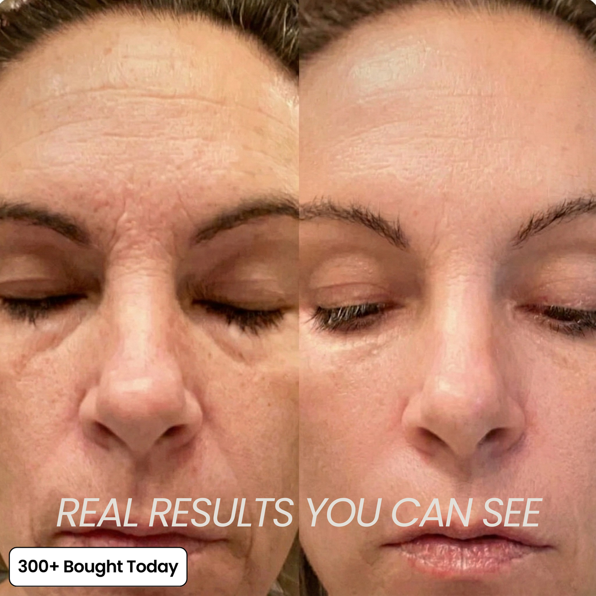 Voluvia™ – Nourishing Volufiline Balm for Plump-Looking Skin