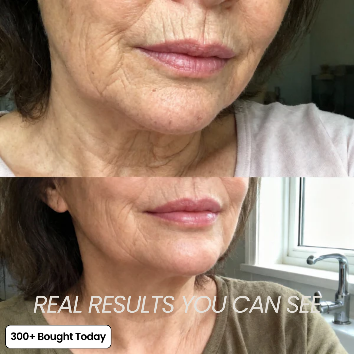 Voluvia™ – Nourishing Volufiline Balm for Plump-Looking Skin