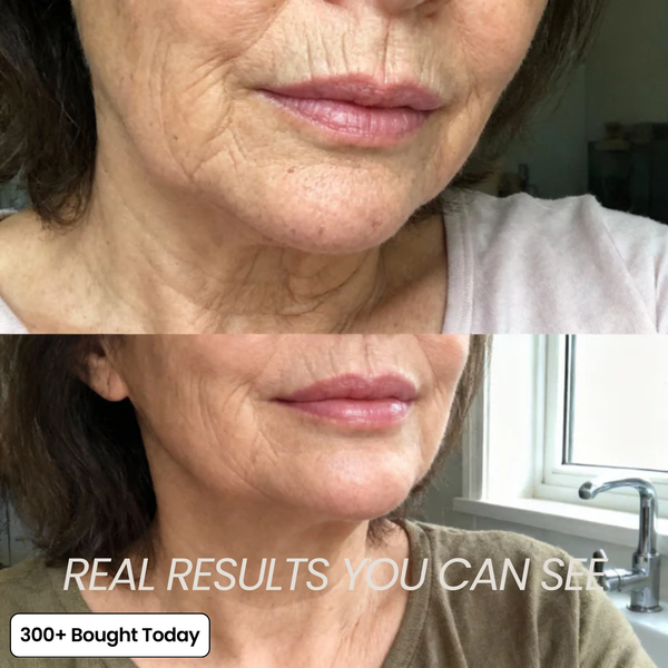 Voluvia™ – Nourishing Volufiline Balm for Plump-Looking Skin