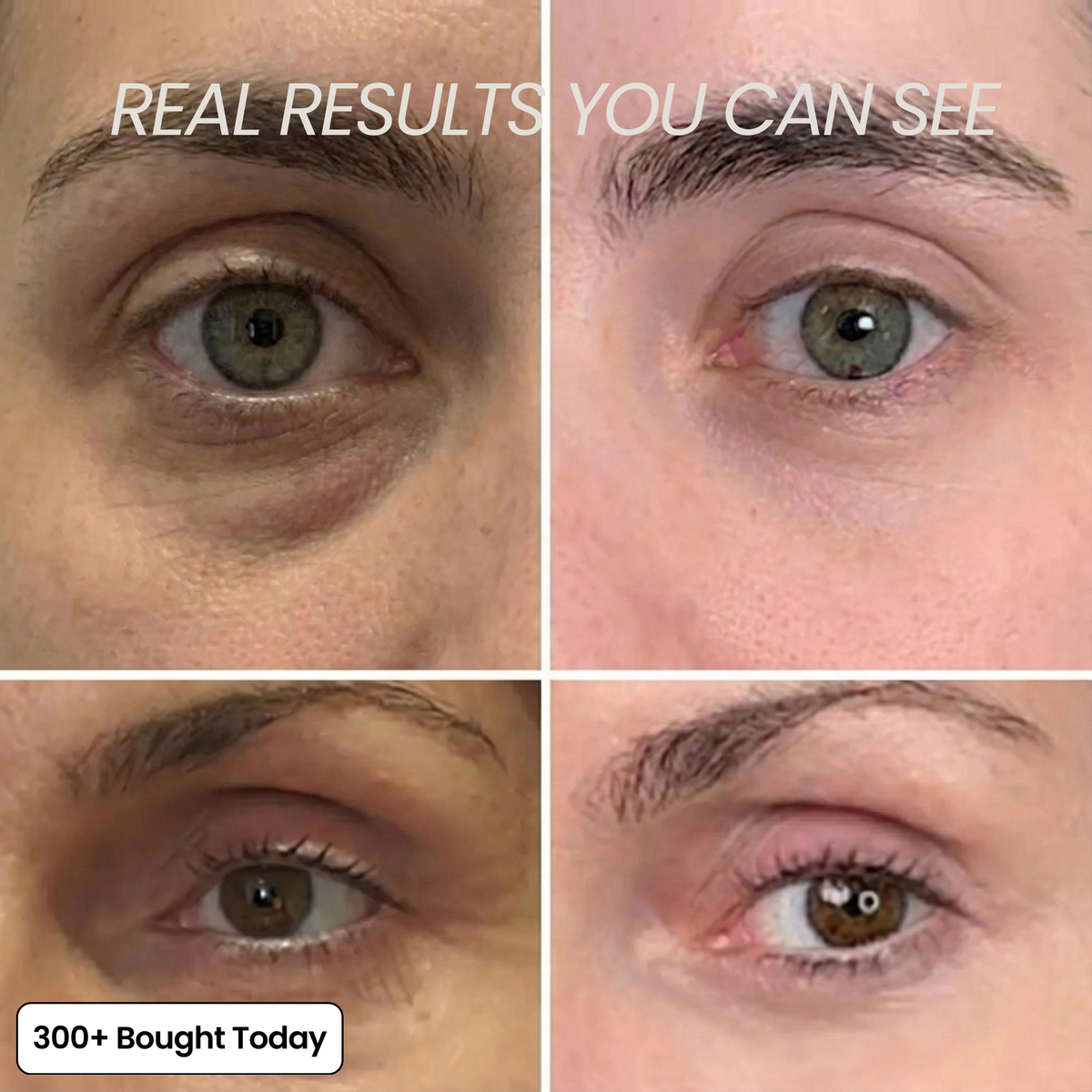 Voluvia™ – Nourishing Volufiline Balm for Plump-Looking Skin