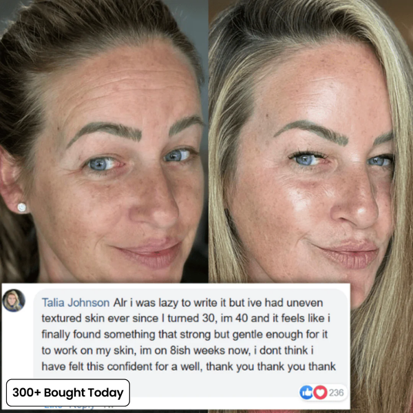 Voluvia™ – Nourishing Volufiline Balm for Plump-Looking Skin