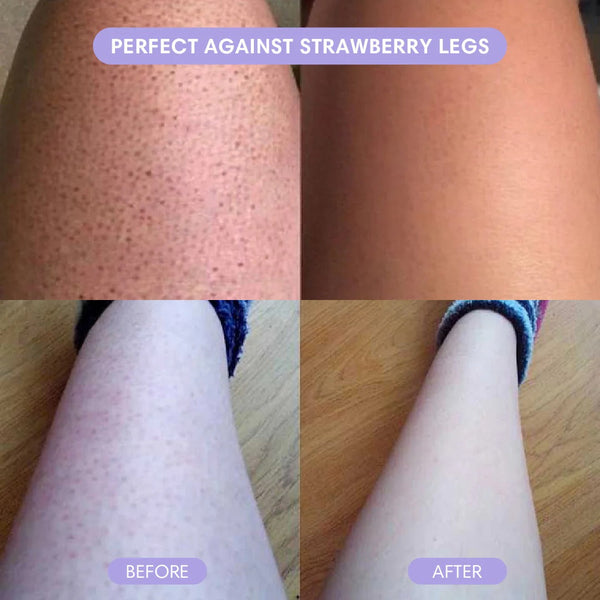 Barevia™ – Easy Hair Removal Mousse for Silky Skin
