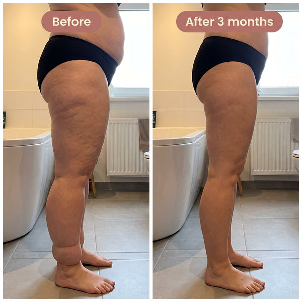 MoveSculpt™ – 3D compression leggings for sculpting leg support