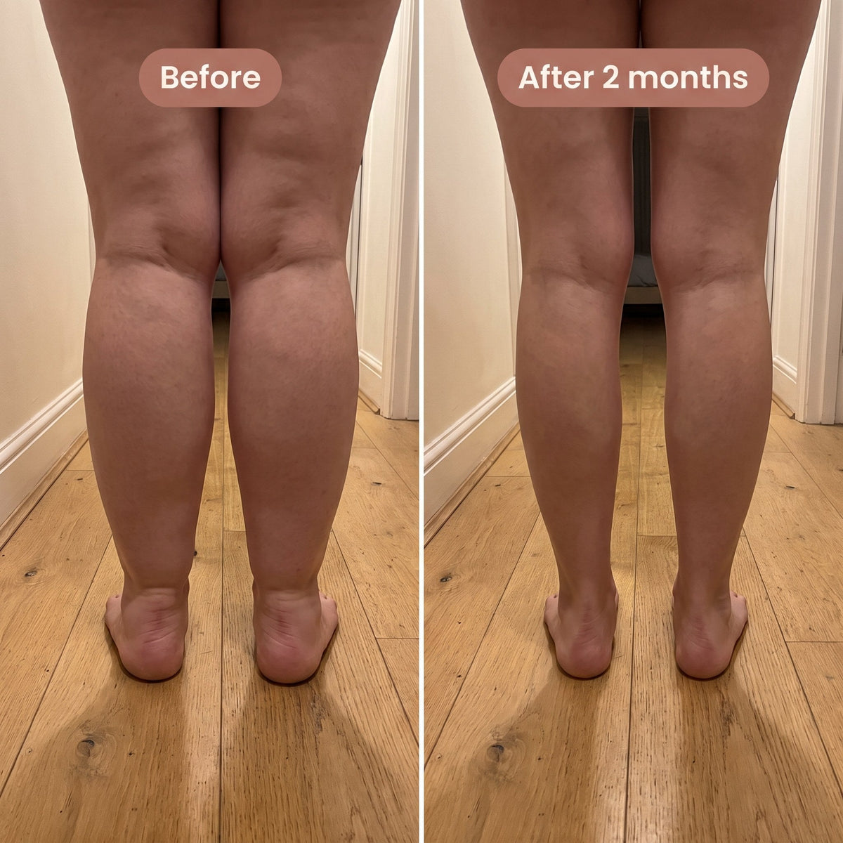 MoveSculpt™ – 3D compression leggings for sculpting leg support